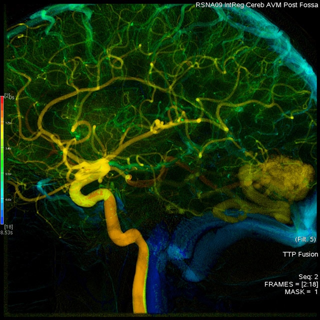 egories-do-not-clone-advanced-visualization-applications-angioviz-aw-angioviz-overview_jpg