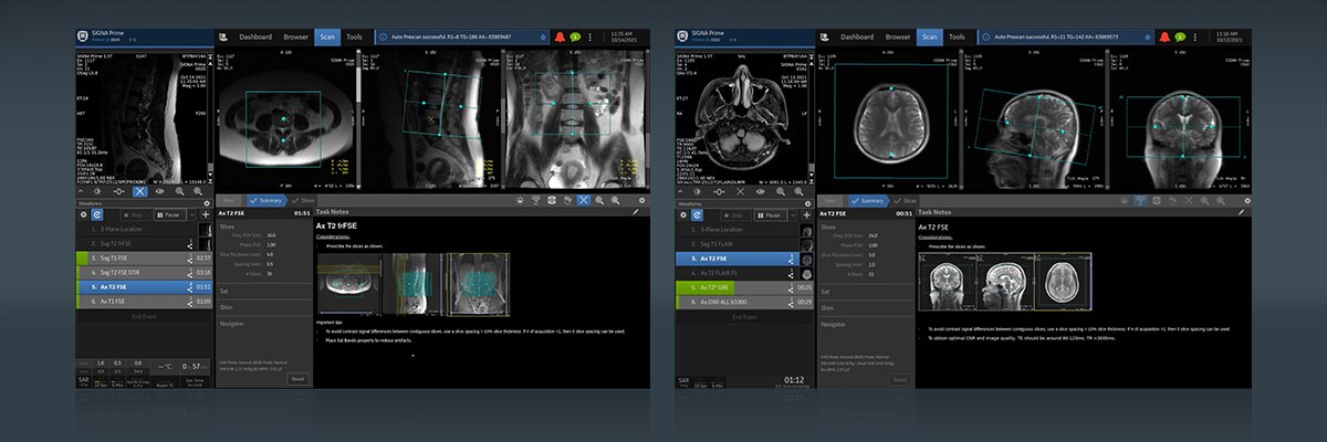 SIGNA Prime PWP Easy To Use Image 2 v2