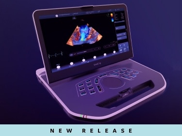 Ecógrafo portátil ofrece gran capacidad cardiovascular - Ultrasonido -  mobile.