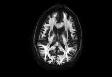 product-product-categories-magnetic-resonance-imaging-signa premier-Image2.png