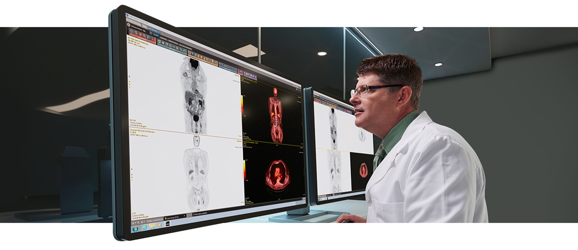 GEHC Discovery IQ Gen 2 Product  Page Motion Correction Image 1