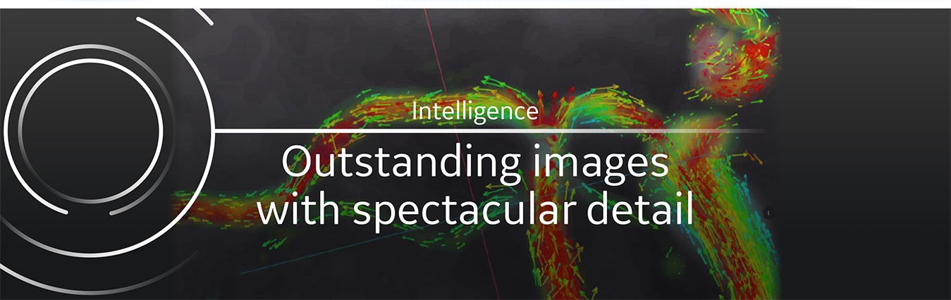 product-product-categories-magnetic-resonance-imaging-signa premier-banner4_png