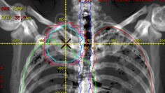 AdvantageSim MD para visualización avanzada.