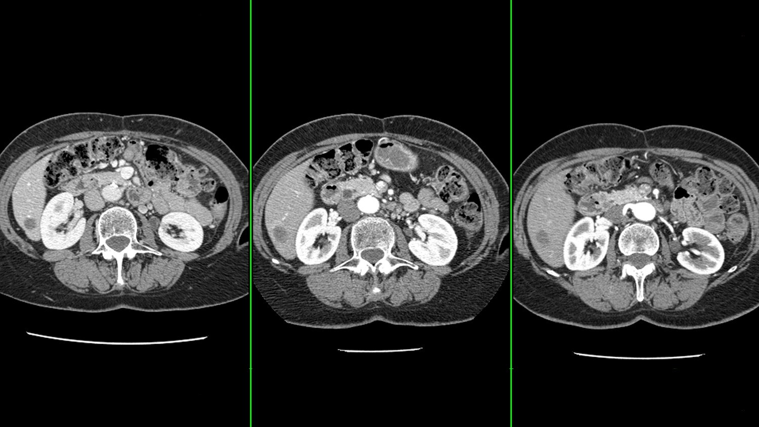 OncoQuant clínico.