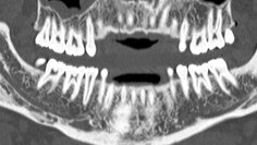 dentascan plus para visualización avanzada