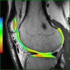 Imagen clínica de READY View