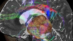 brain view plus para visualización avanzada.