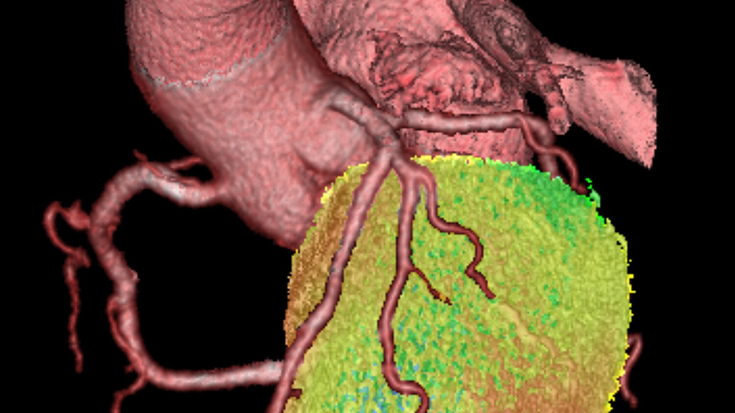 CardIQ Fusion para visualización avanzada