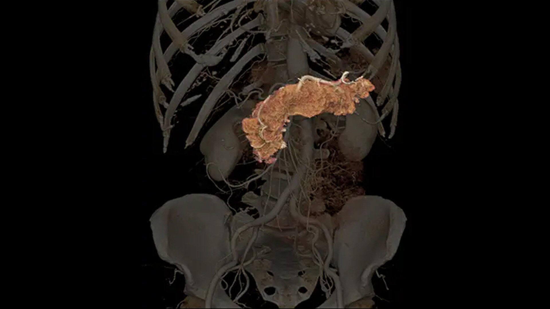 Product Media Carousel Image