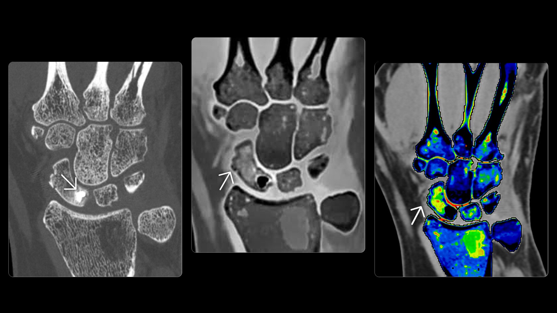 Product Media Carousel Image