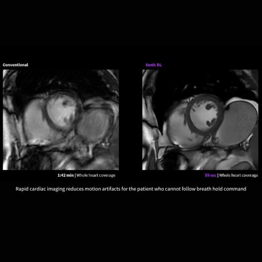 Collection Carousel Image