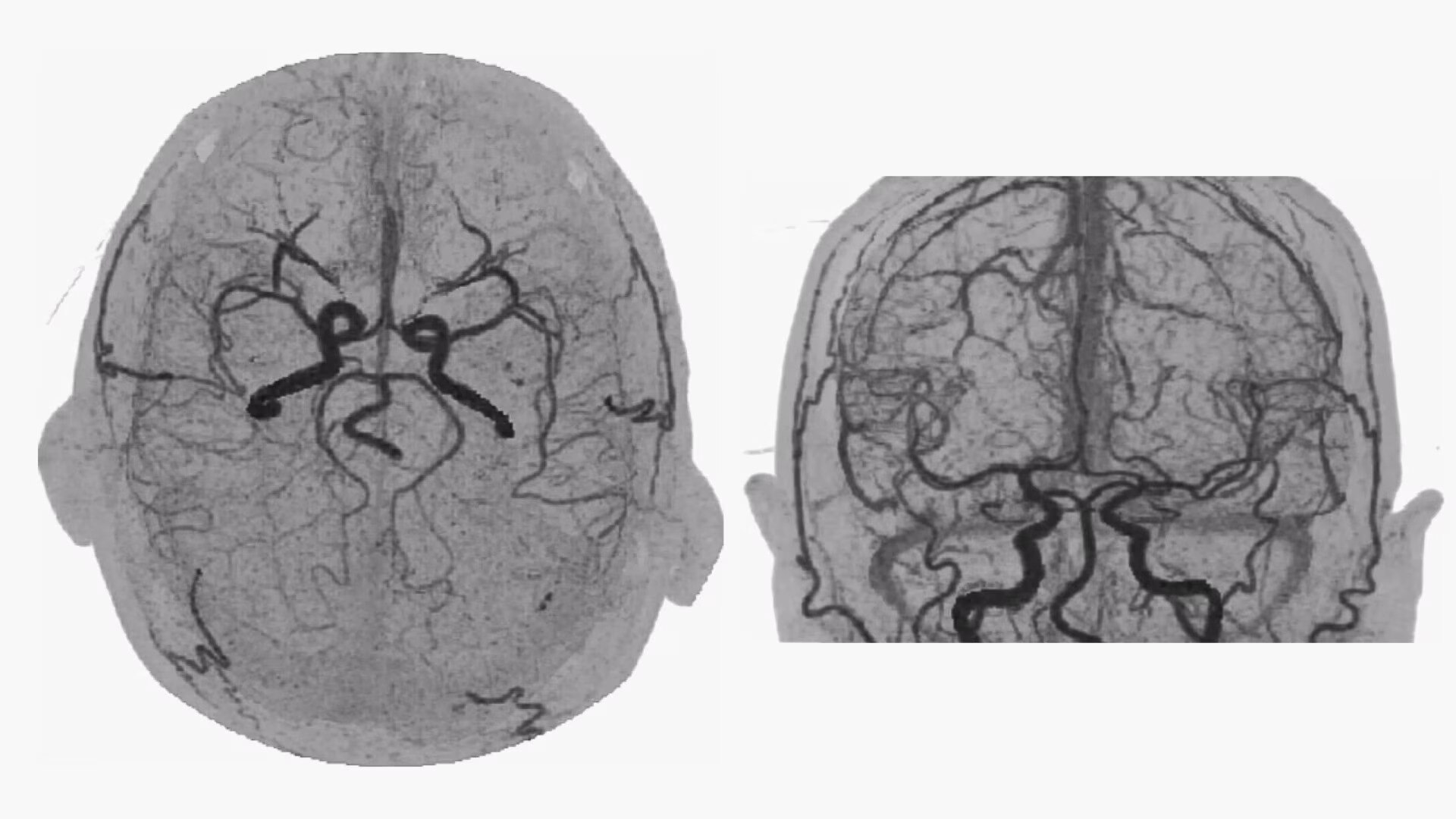 Product Media Carousel Image