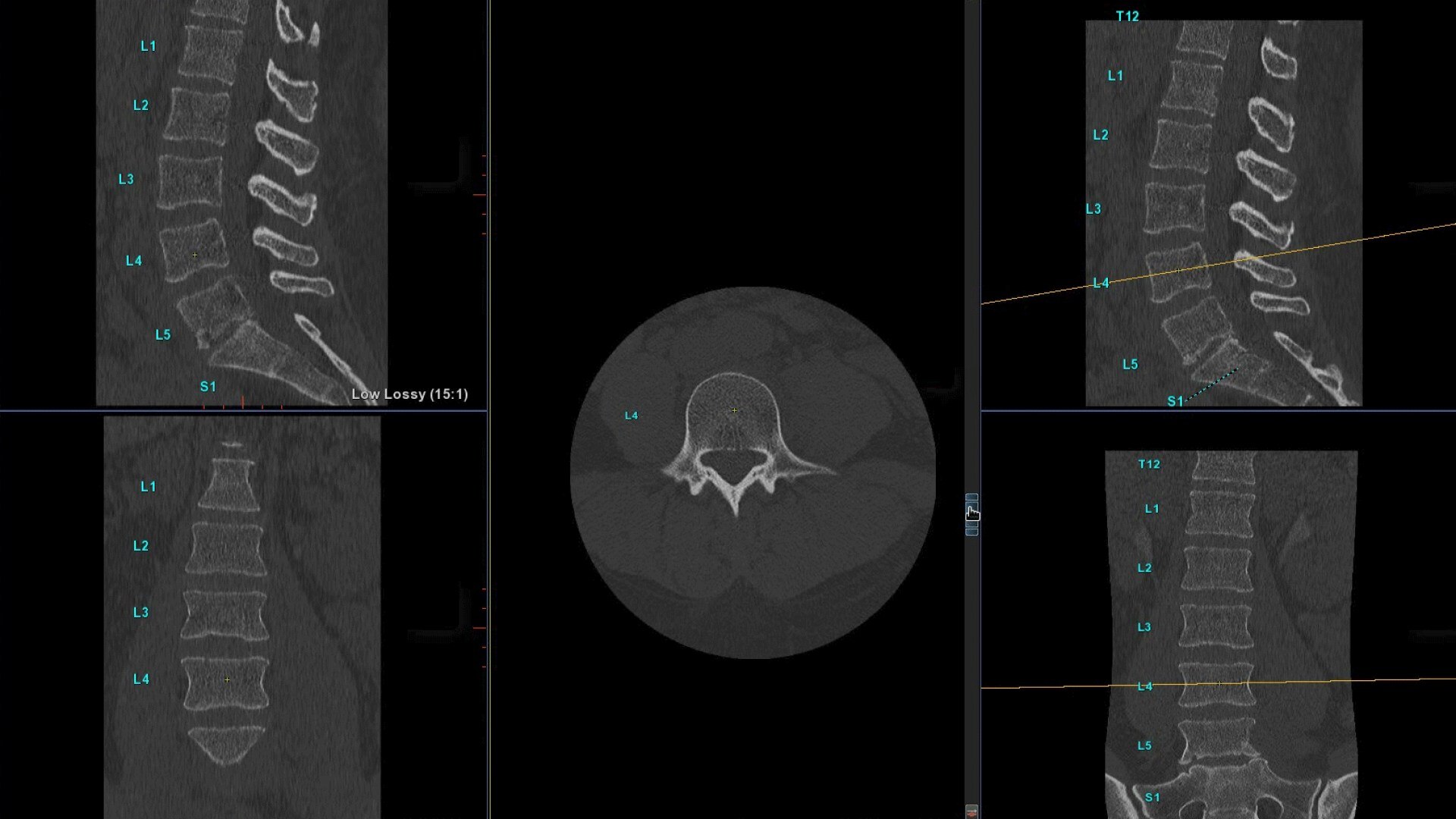 Product Media Carousel Image