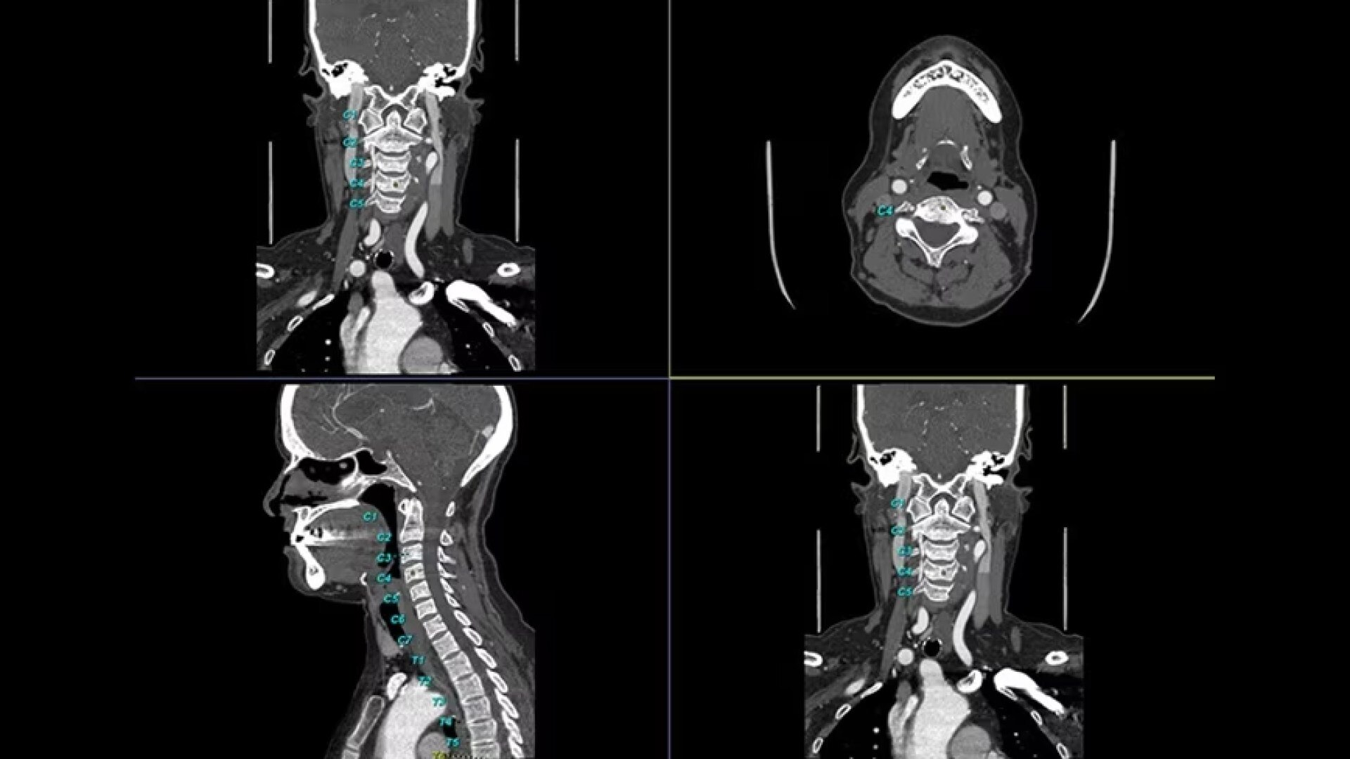 Product Media Carousel Image