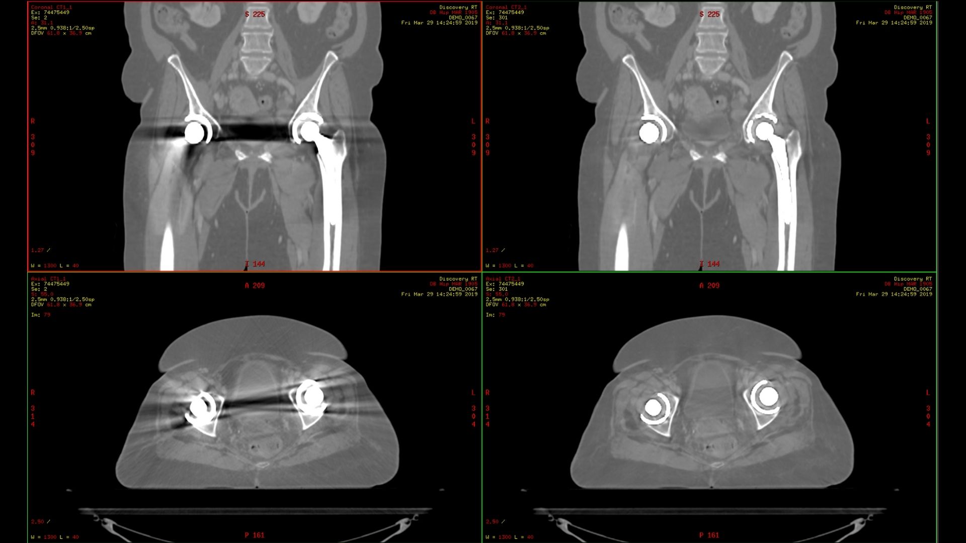Product Media Carousel Image