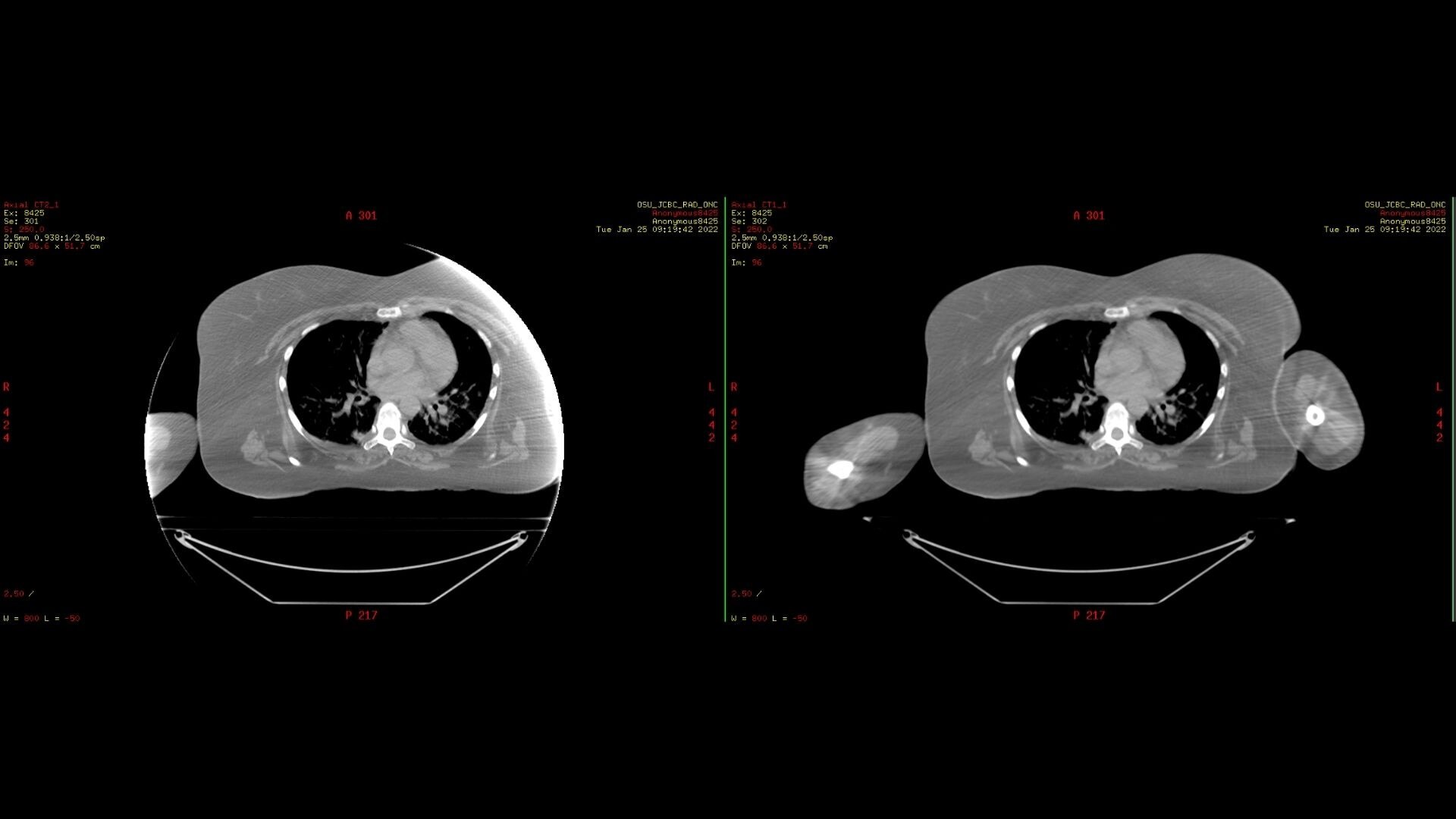 Product Media Carousel Image