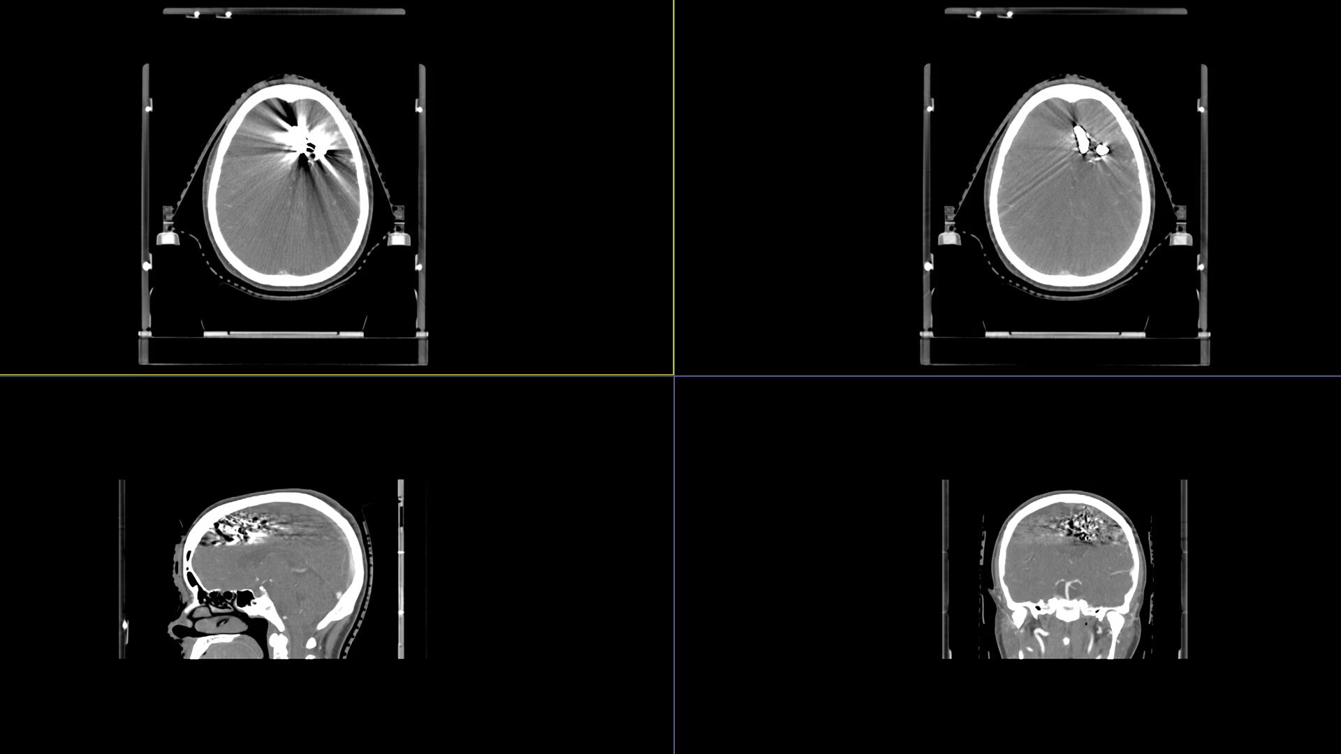 Product Media Carousel Image
