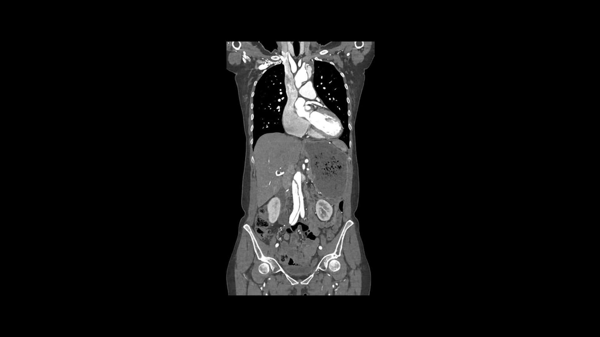 Product Media Carousel Image