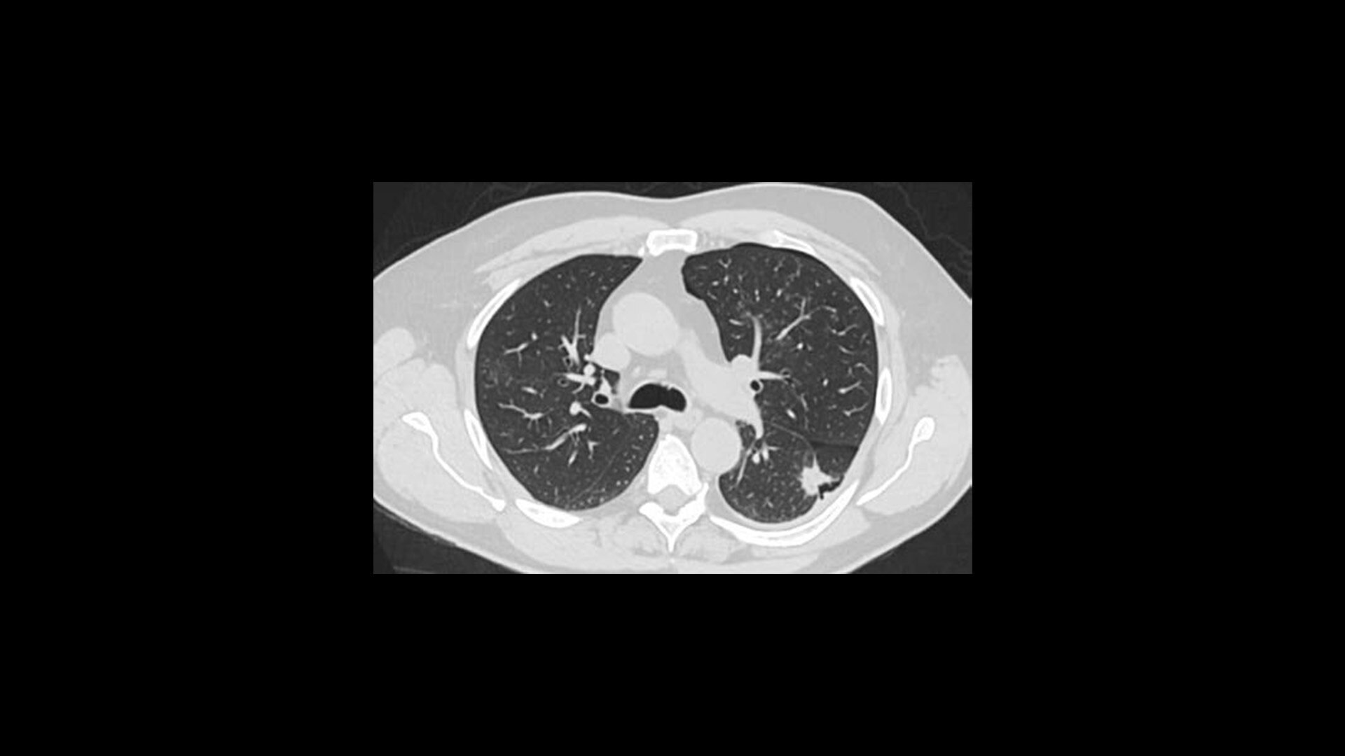 Product Media Carousel Image