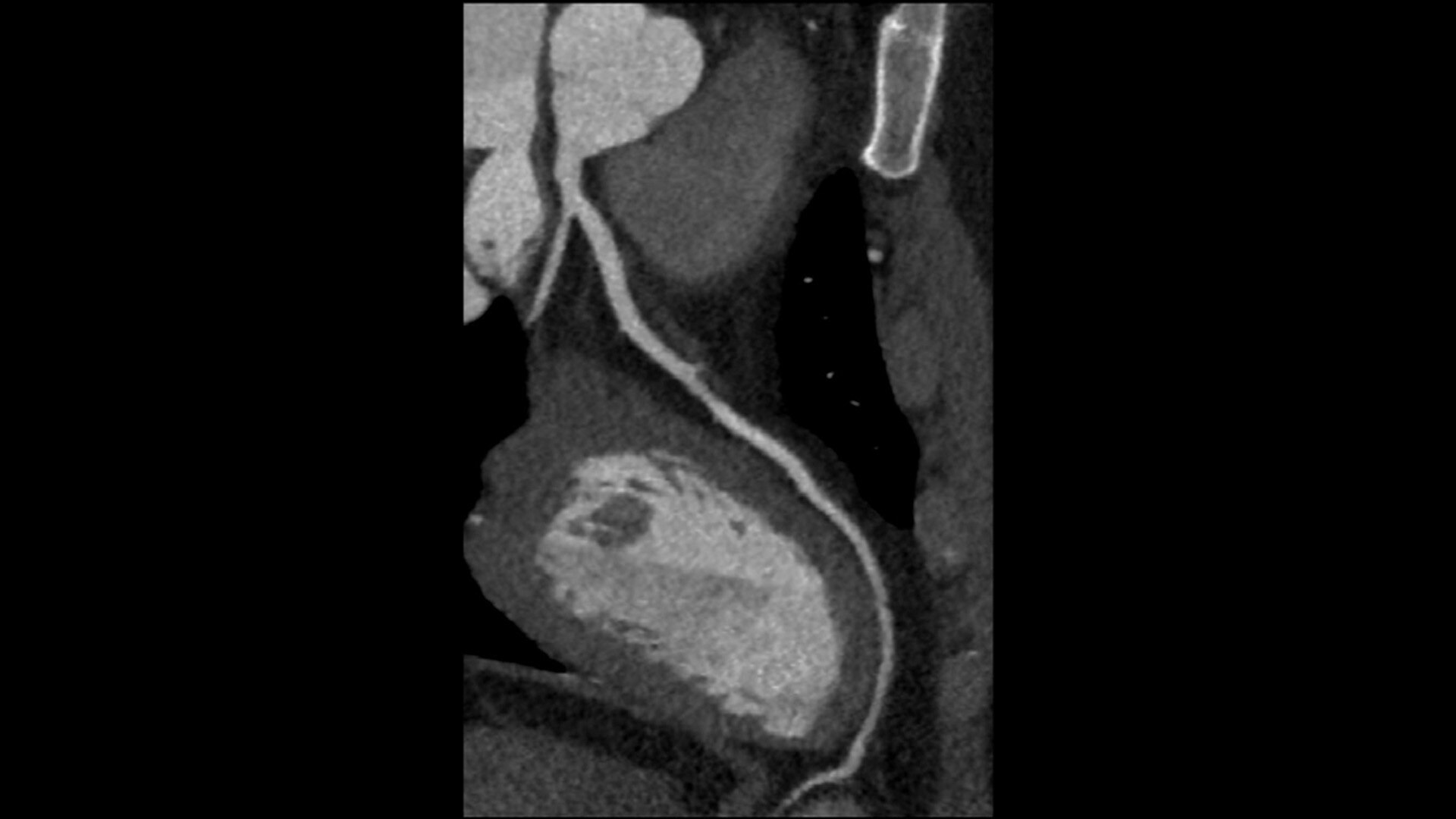 Product Media Carousel Image