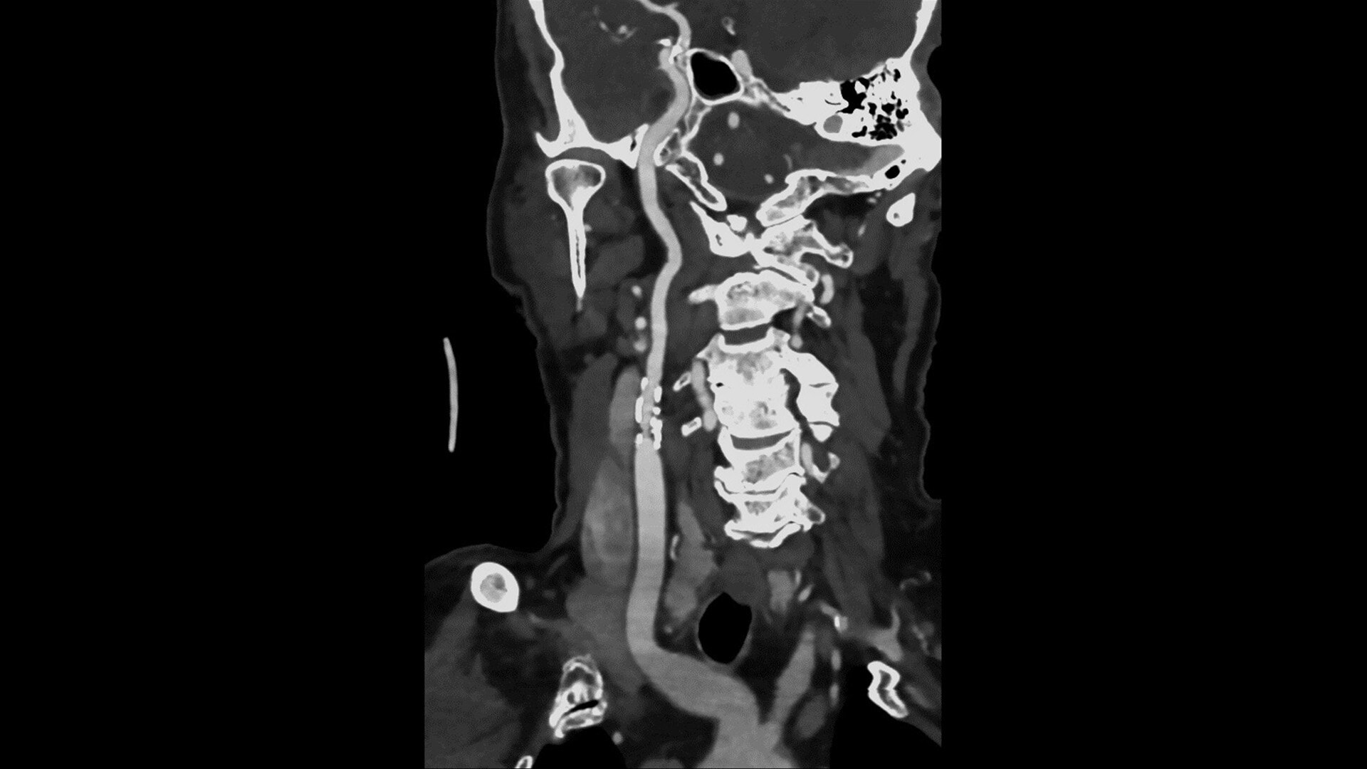 Product Media Carousel Image