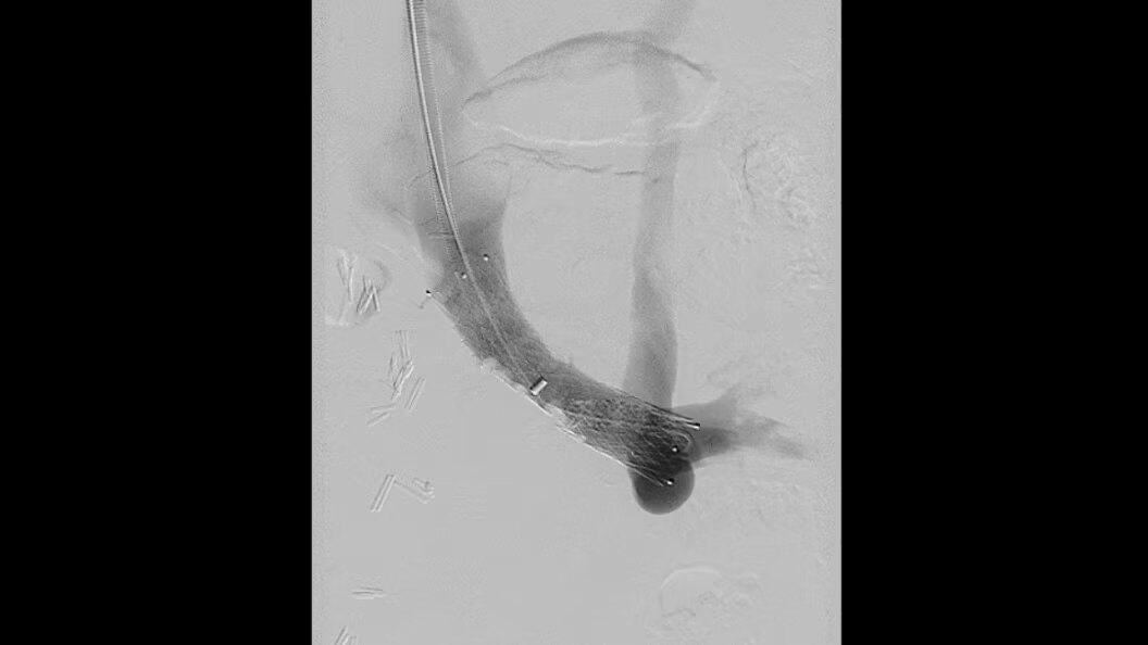 Product Media Carousel Image