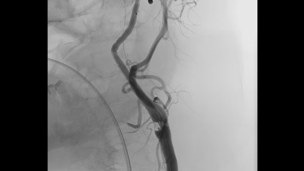 Product Media Carousel Image