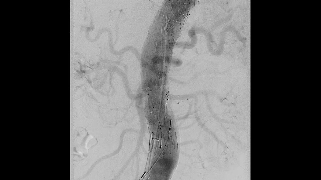 Product Media Carousel Image