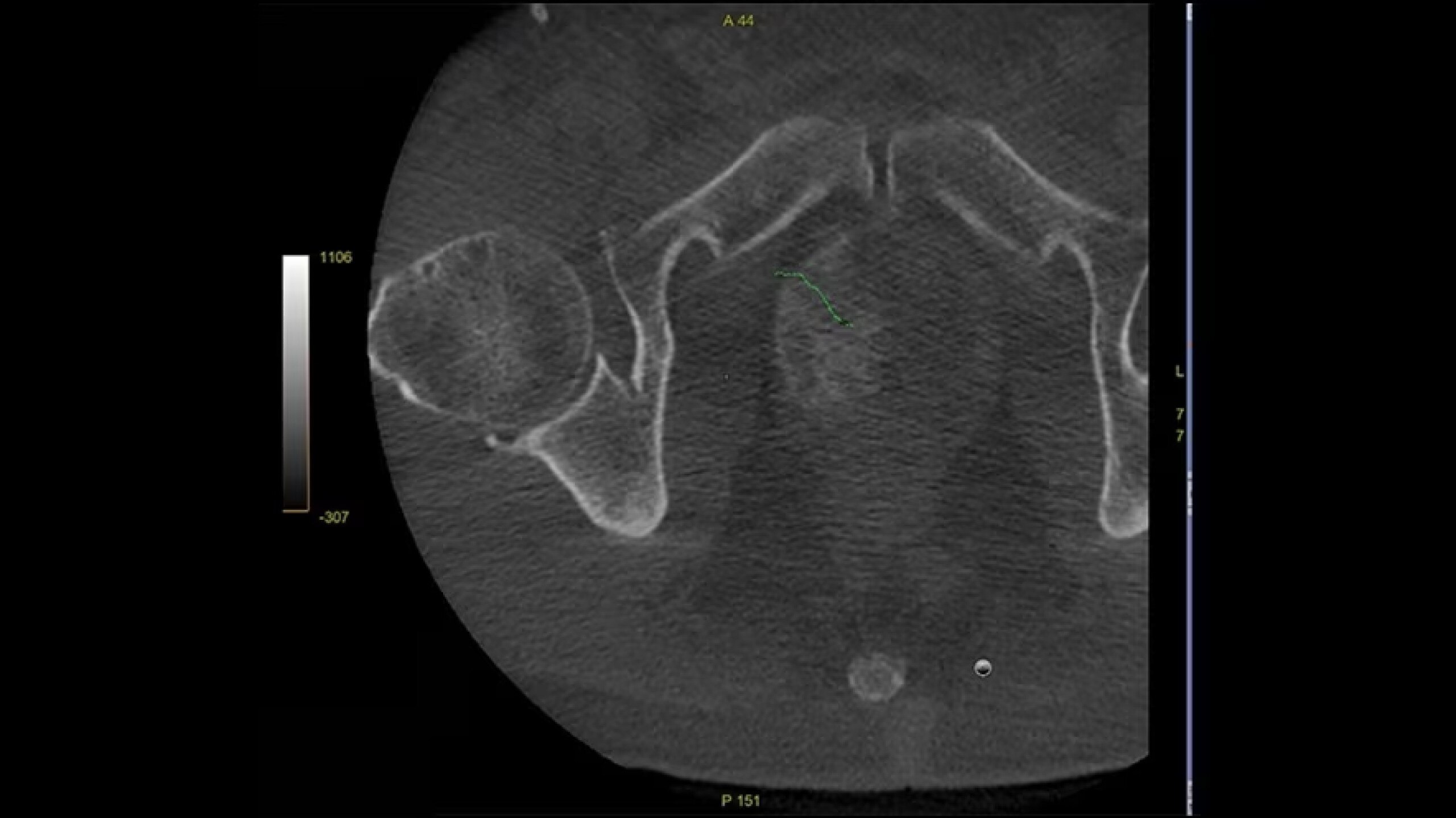 Product Media Carousel Image