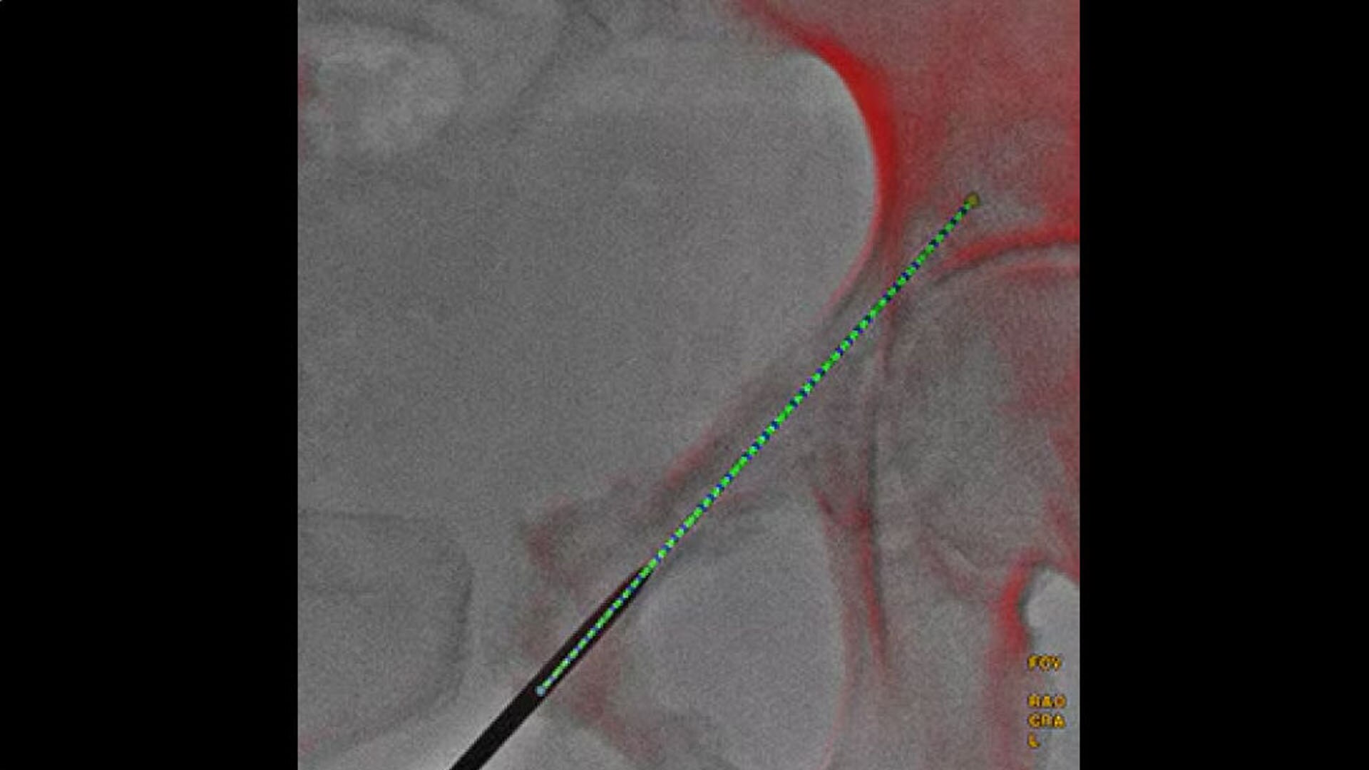 Product Media Carousel Image