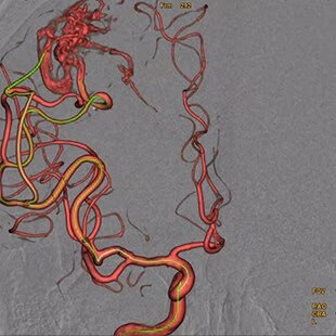 Product Media Carousel Image