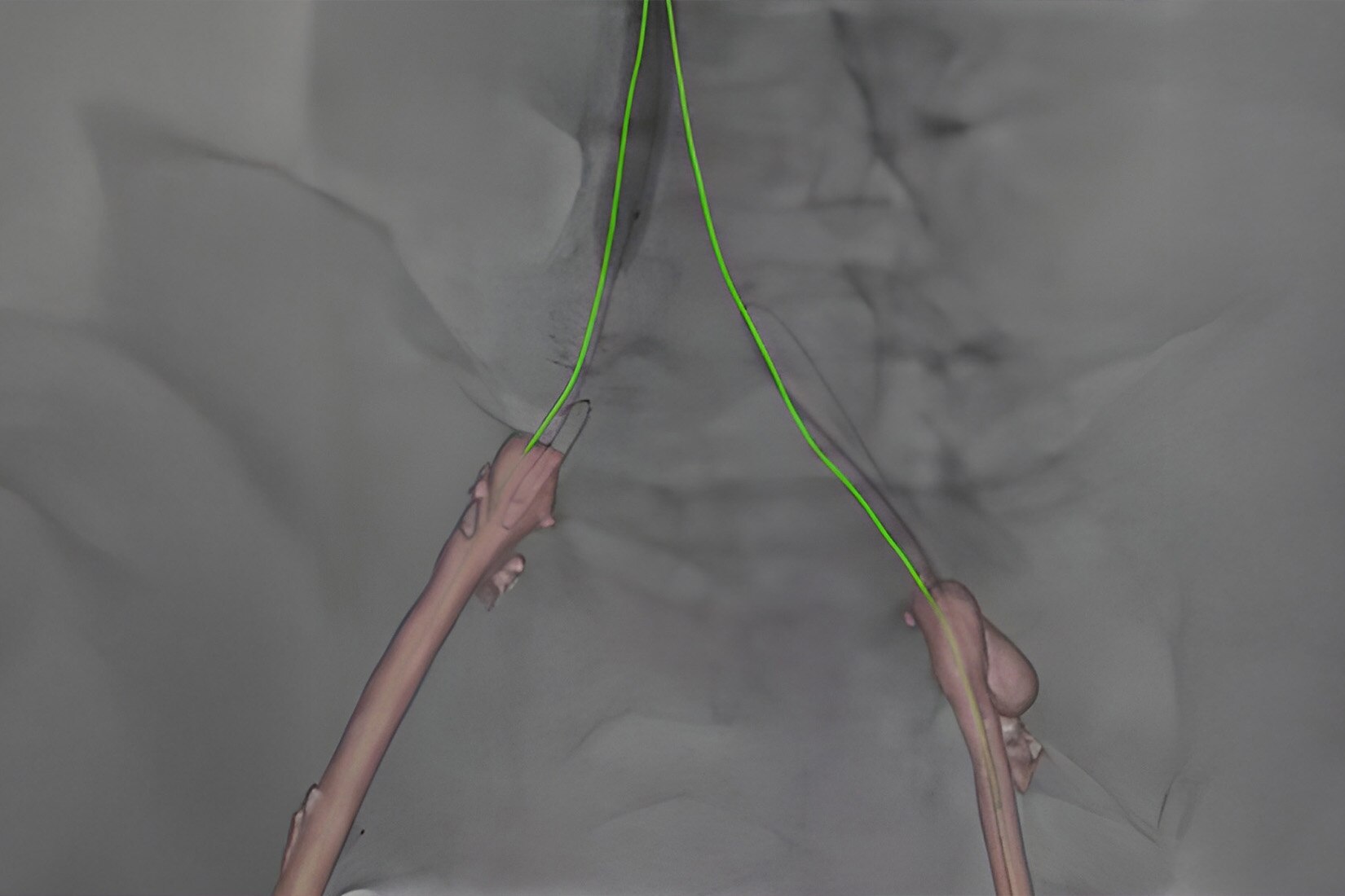 Product Media Carousel Image