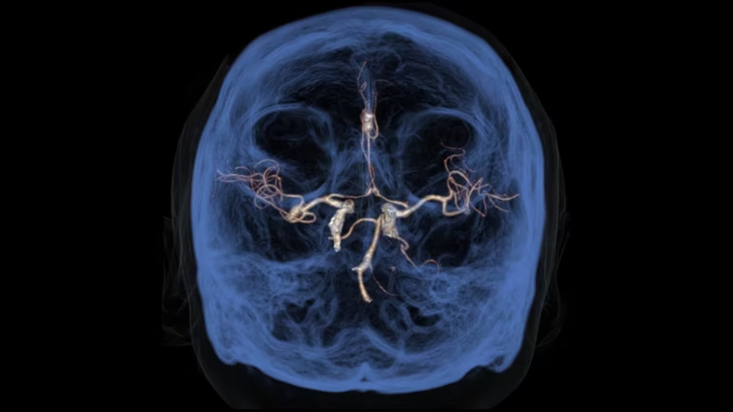 Product Media Carousel Image