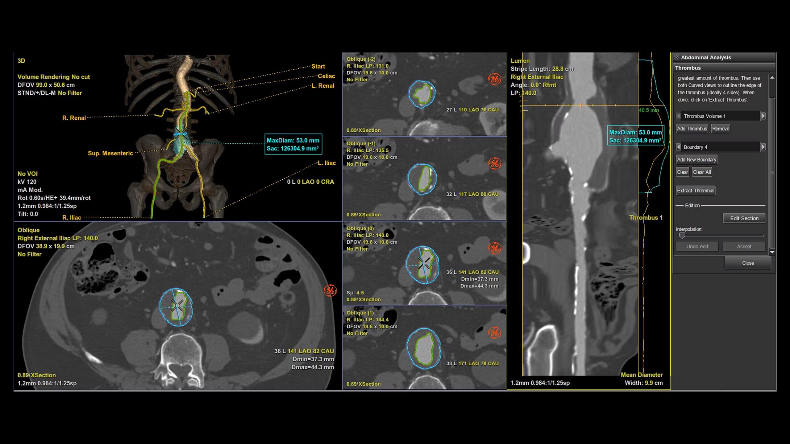 Product Media Carousel Image