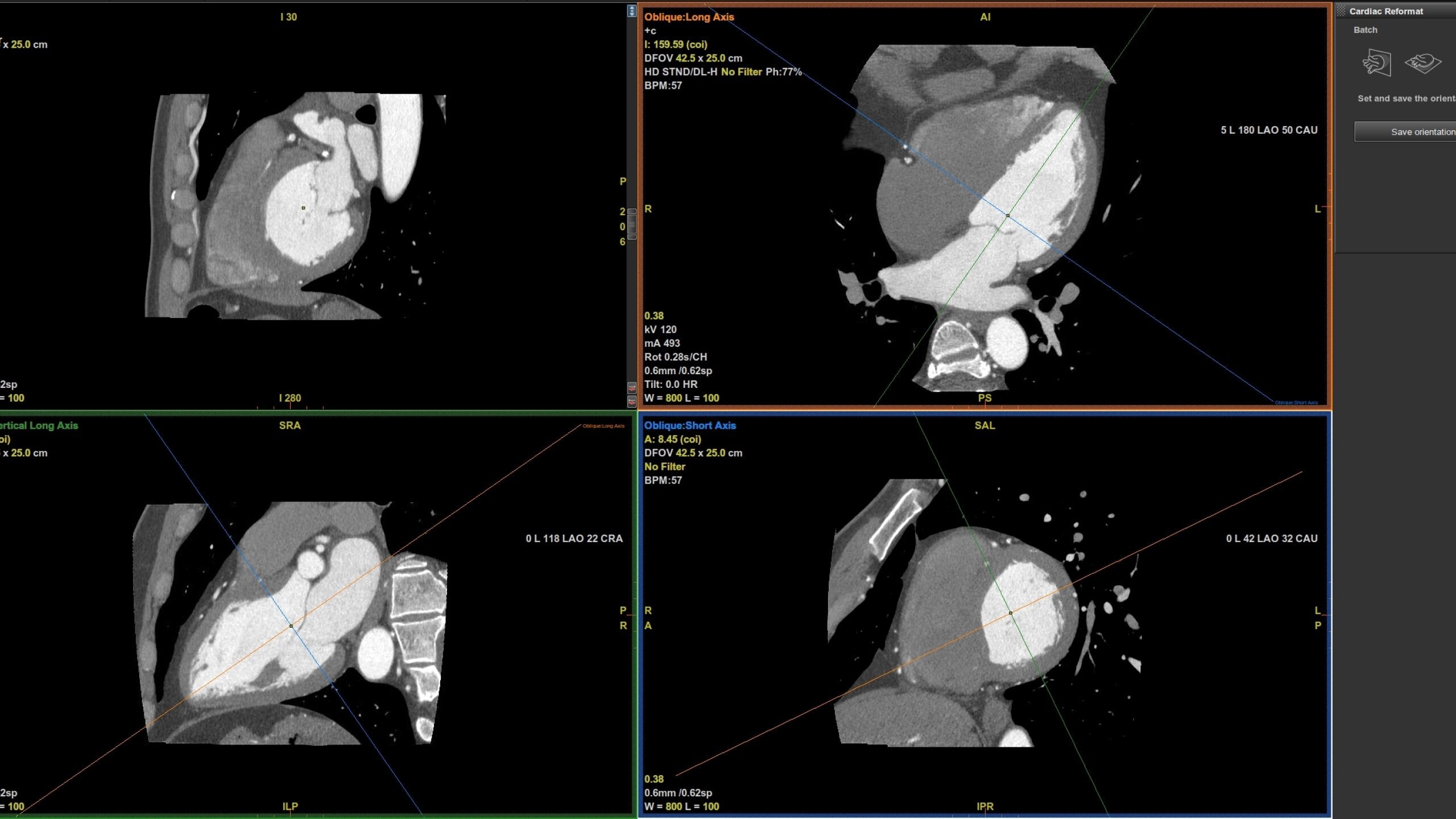 Product Media Carousel Image