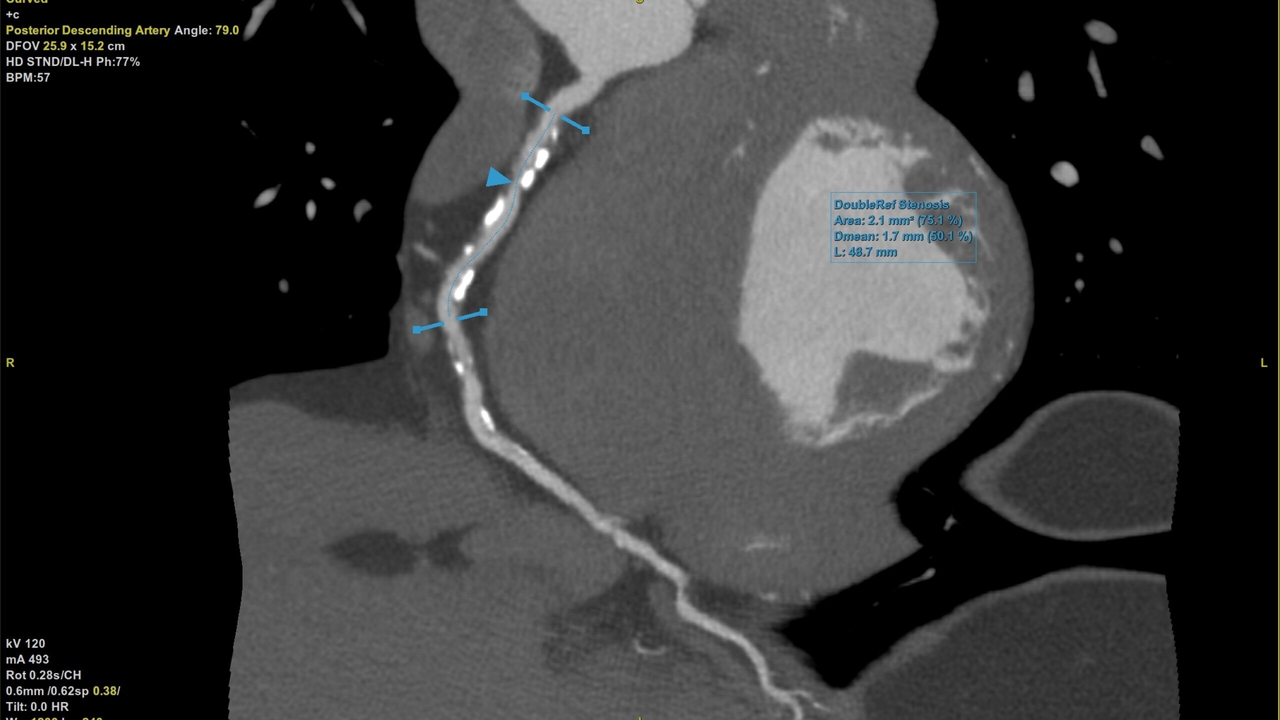 Product Media Carousel Image