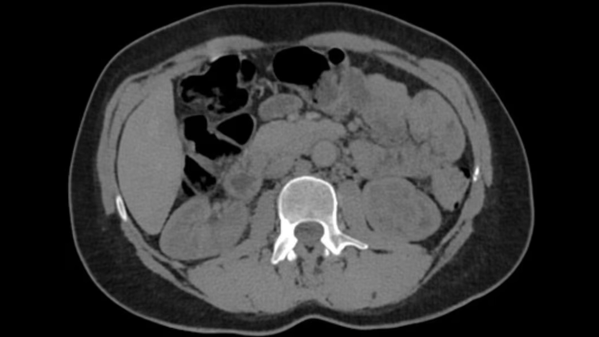 Product Media Carousel Image