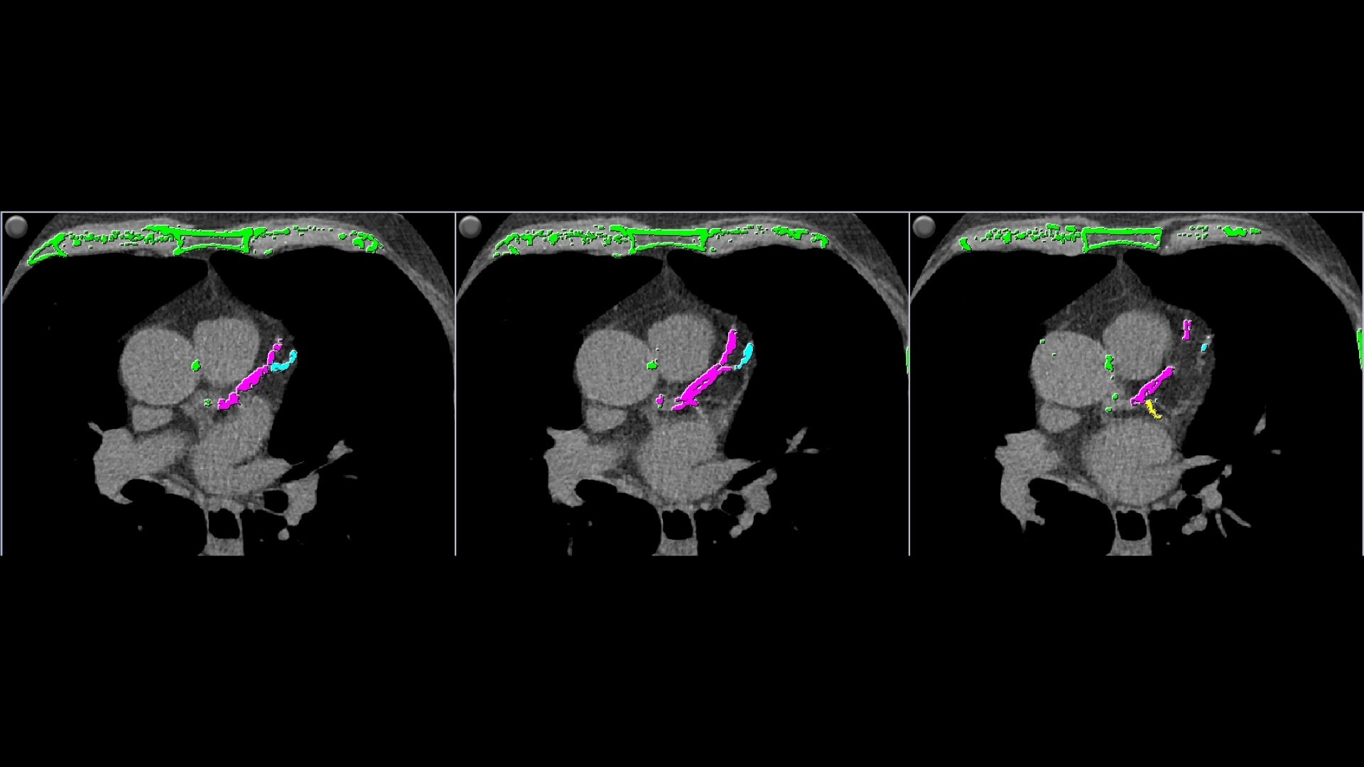 Product Media Carousel Image