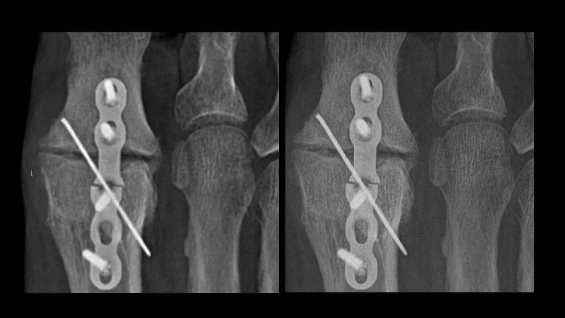 Product Media Carousel Image