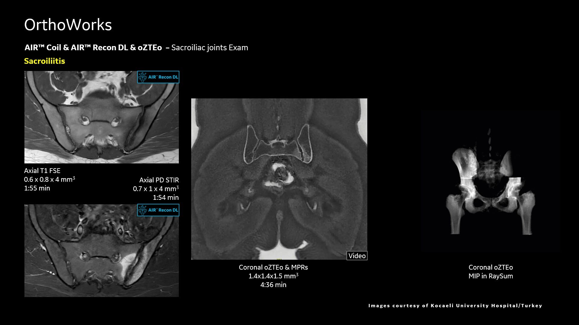 Product Media Carousel Image