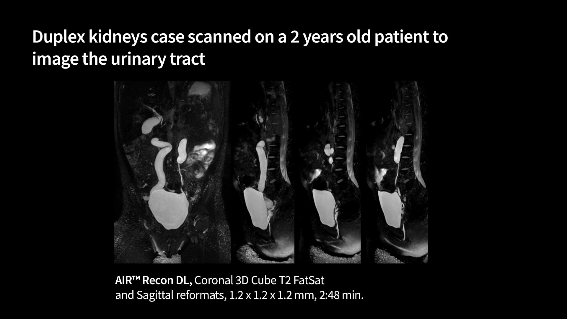 Product Media Carousel Image