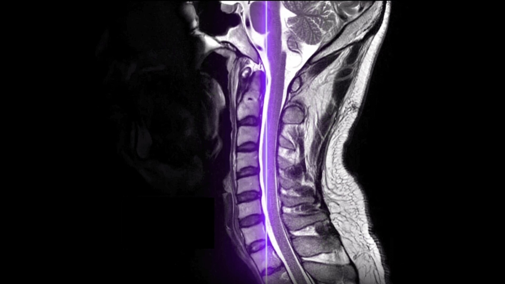 Collection Carousel Image