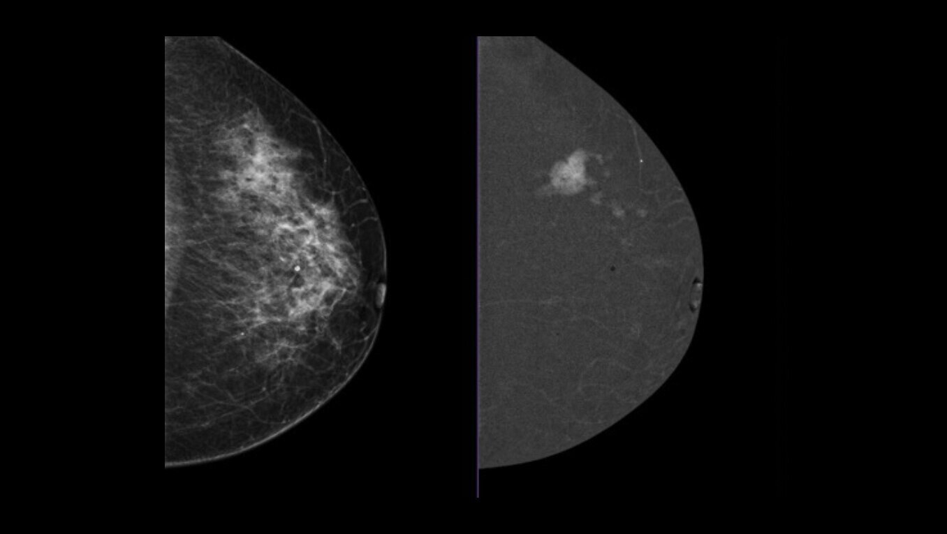 Product Media Carousel Image