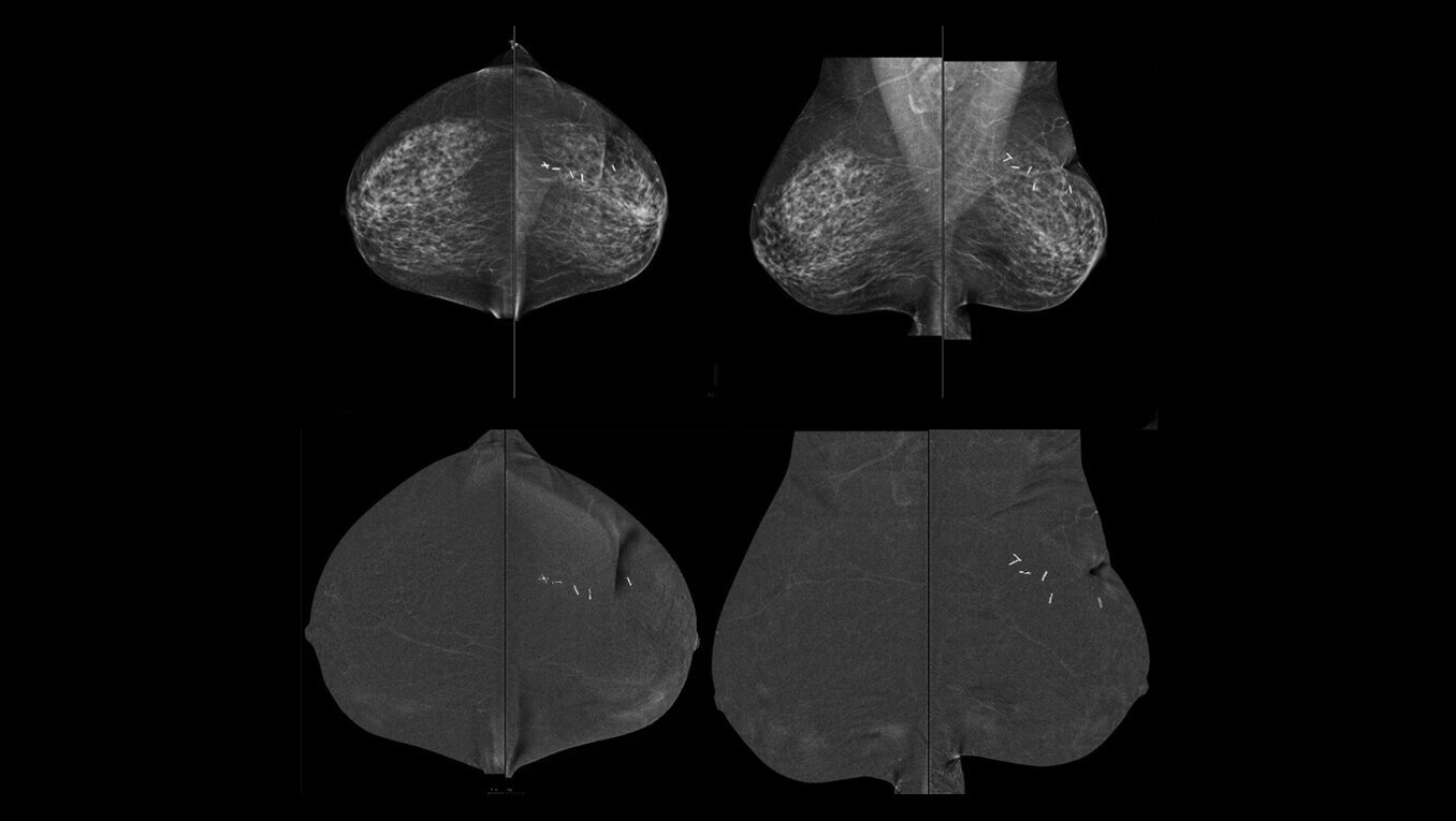 Product Media Carousel Image