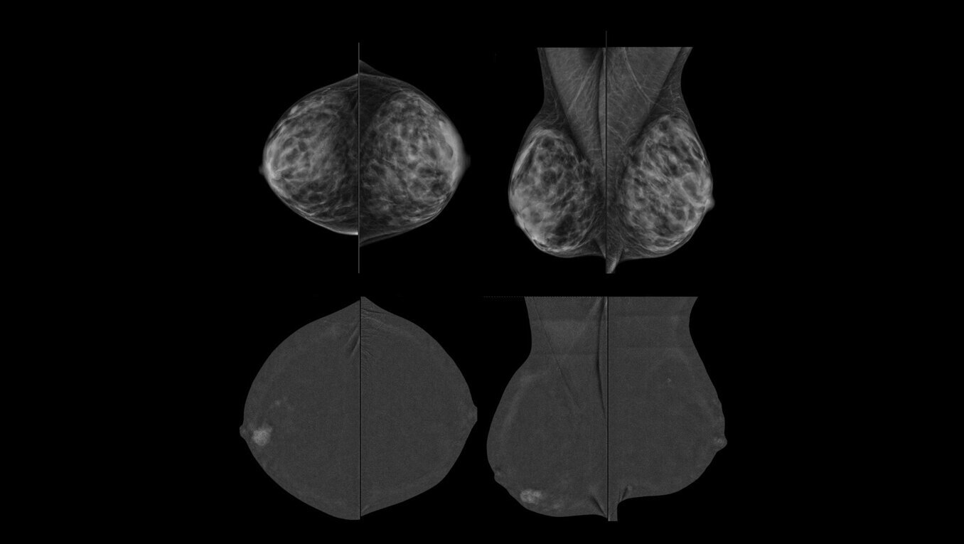 Product Media Carousel Image