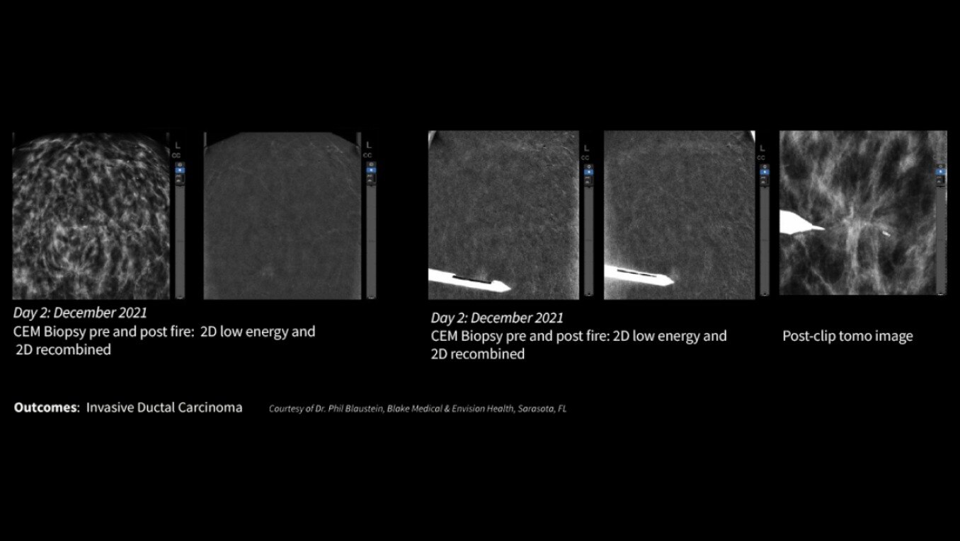 Product Media Carousel Image