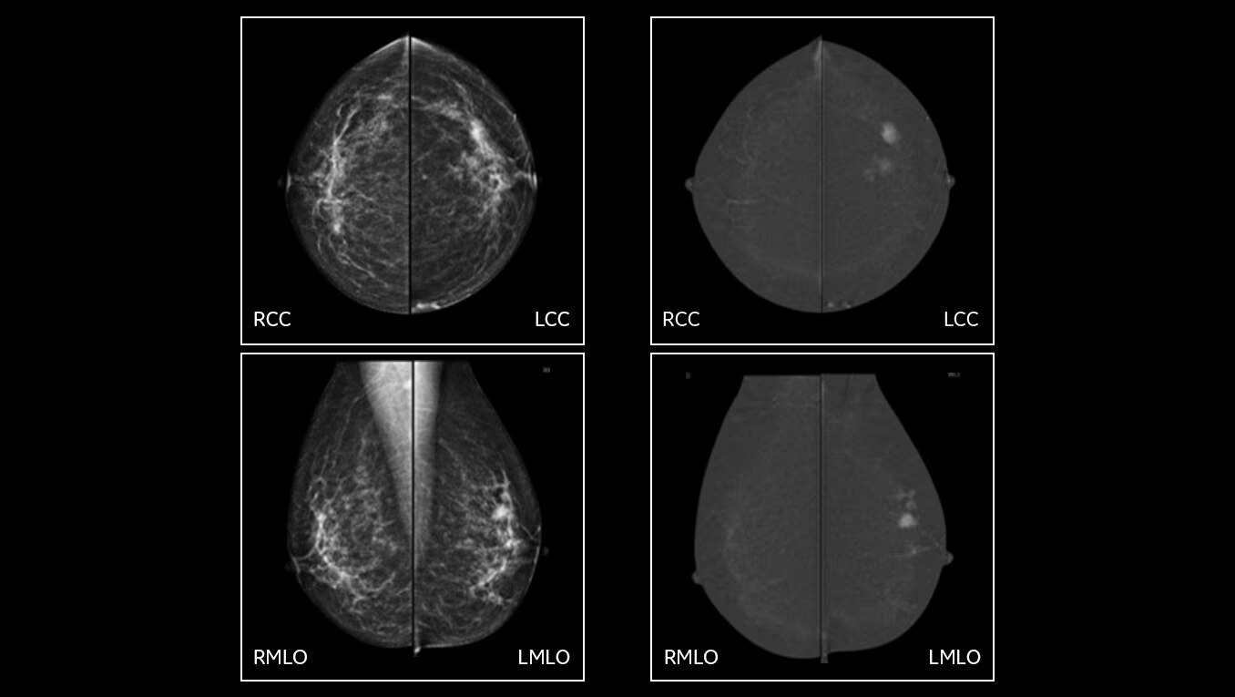 Product Media Carousel Image