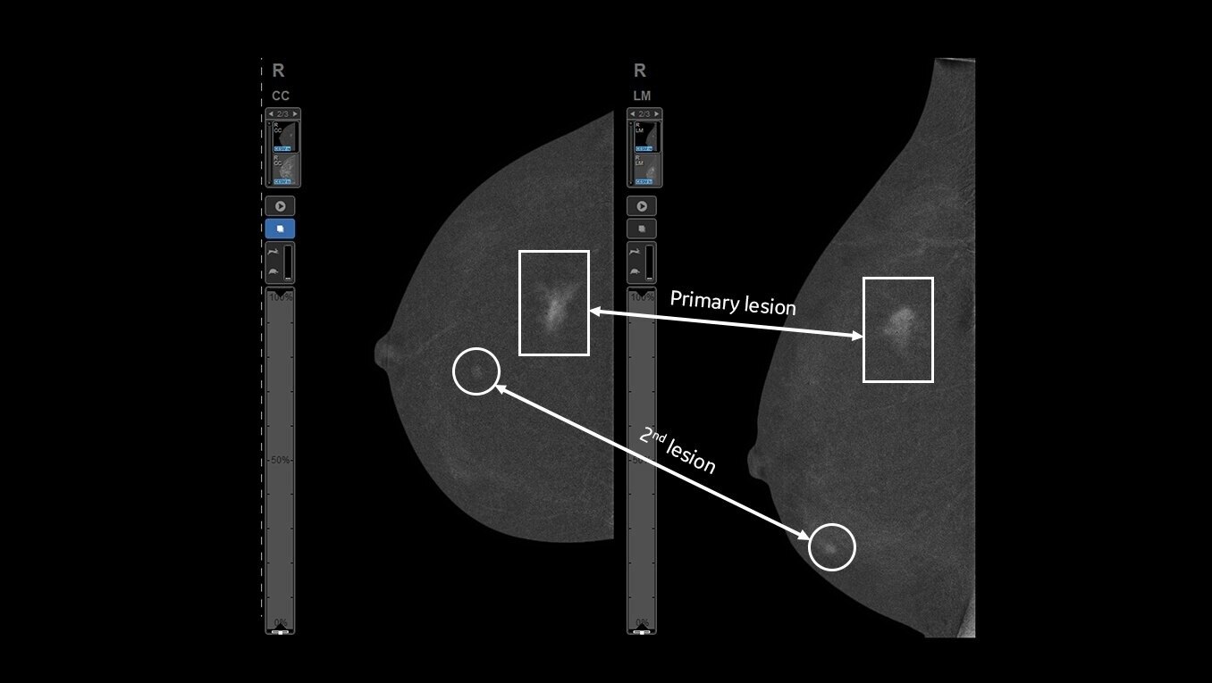 Product Media Carousel Image