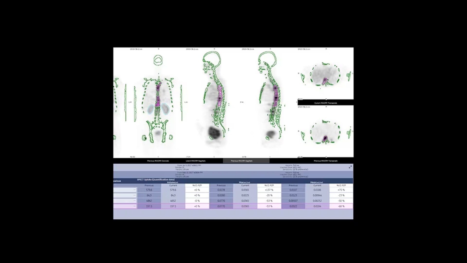 Product Media Carousel Image
