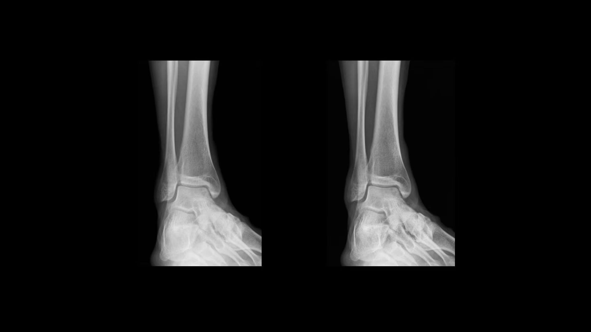 Product Media Carousel Image